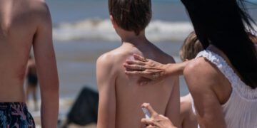 Salud brindó recomendaciones para evitar daños en la piel por el sol