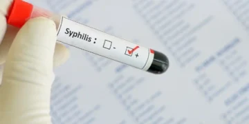 Alerta Sanitaria en Córdoba: La Sífilis Rompe Récords con Aumento del 37% en Tres Años
